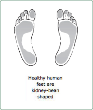 Healthy feet have strong arches
